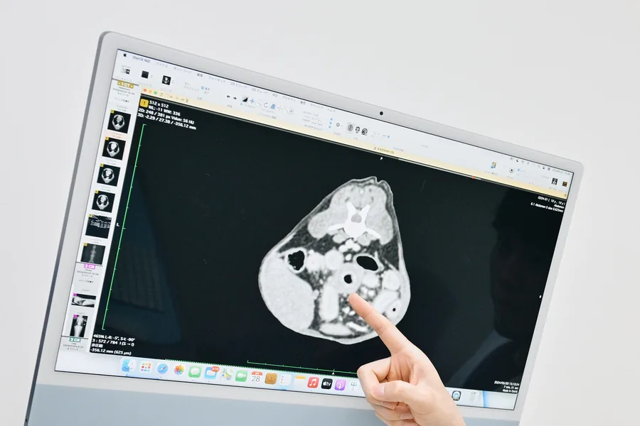 モニタに映した CT 画像を指し示して説明する様子